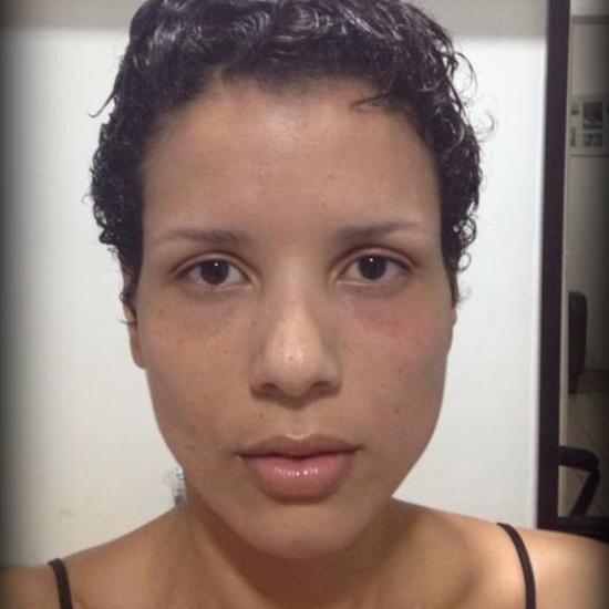 Antes e Depois