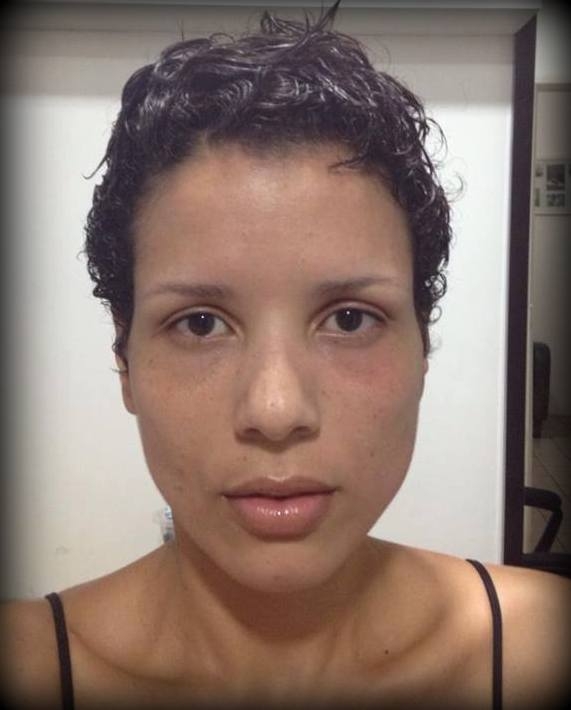 Antes e Depois